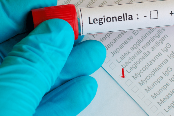 legionella test