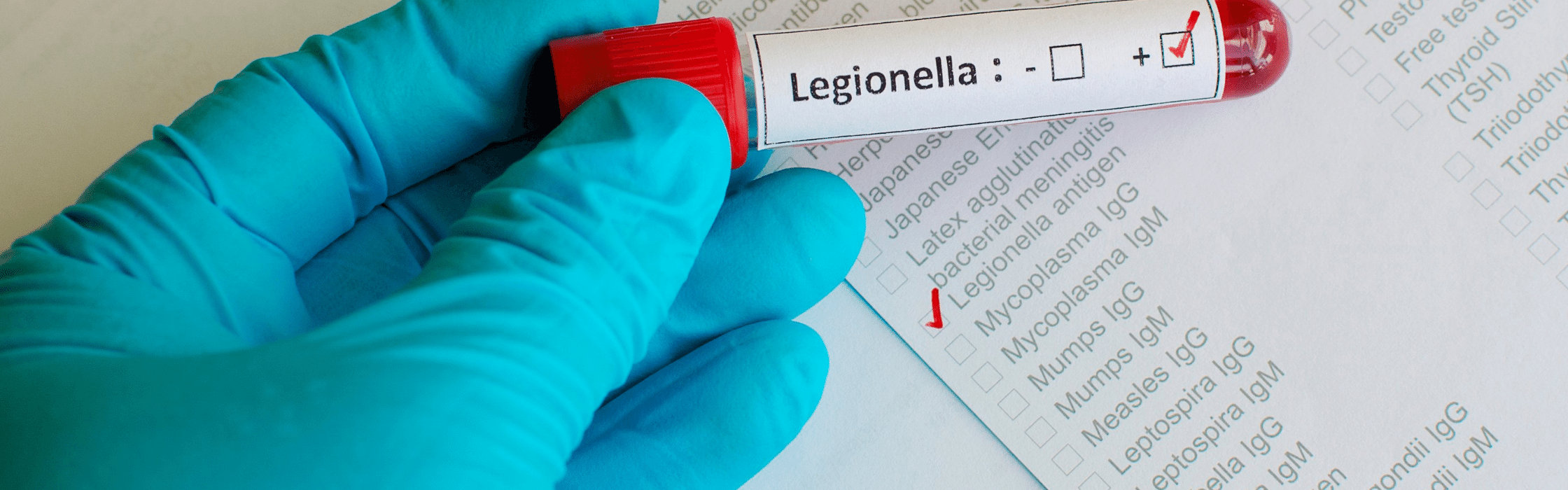 legionella test